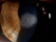 Curs Trencant barreres en l’adaptació de lents de contacte